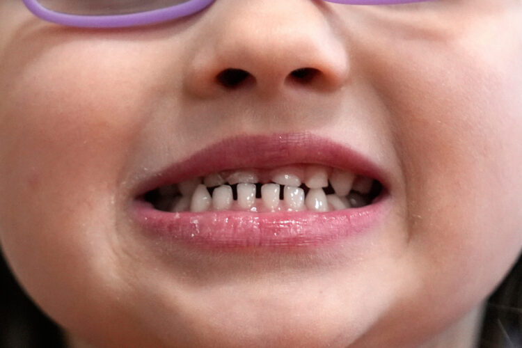 MDHHS launches bidding process for Healthy Kids Dental contract
